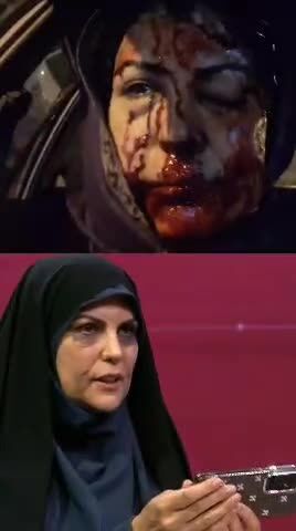 ببینید| شاهد عینی از ساچمه‌زنی به صورت: می‌خواست مرا بکشد
